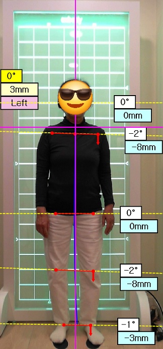 엑스바디 측정한후 자세교정과 체형교정을 진행합니다.