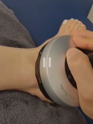 분당 근막관리 울트라니들 체외충격파 운동