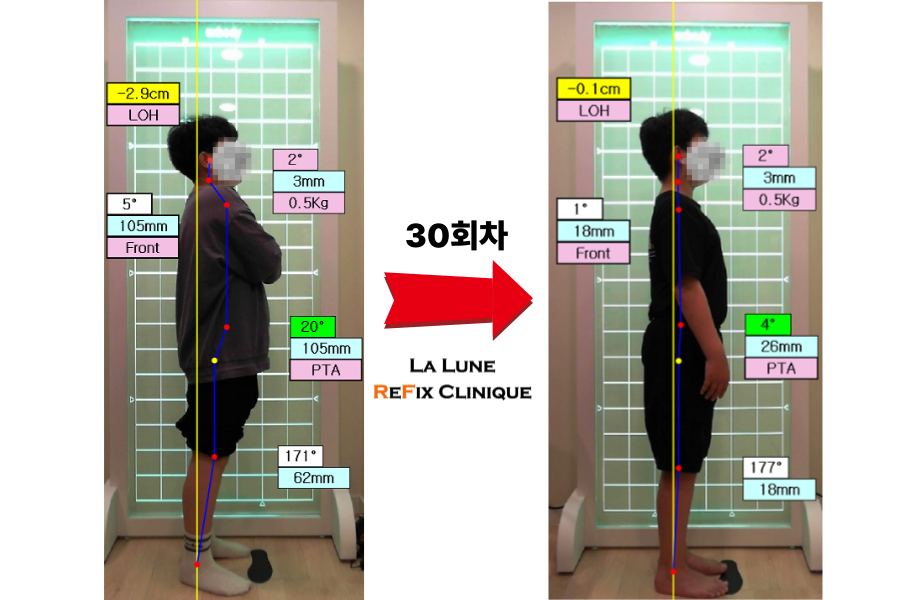 김O성님- 전후비교 30회차.png